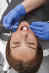 Obraz na płótnie Canvas Vertical top view close up of woman getting dental examination