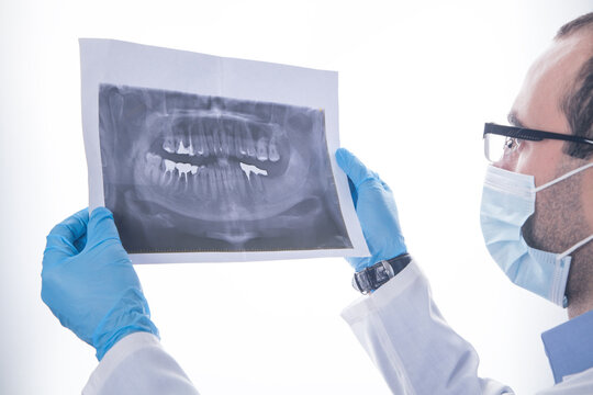 Caucasian doctor holding at teeth x-ray image.