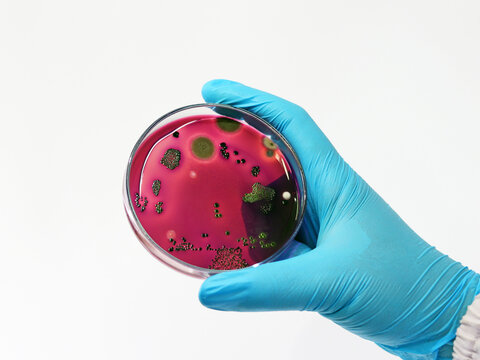 Scientist test Escherichia coli (E.coli) culture with Eosin Methylene Blue (EMB) Agar in Petri dish show the metallic green sheen colony, hold in hands with nitrile gloves isolate in white background.