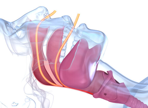 Sleep apnea syndrome. Labeled nasal tongue blocked airway, 3D illustration