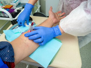 A Nurse In The Clinic Inserts A Catheter Into A Vein For Blood Testing For A man. blue medical gloves. close up.