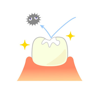 illustrations of dental sealants treatment before after