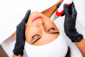 Dermapen apparatus in the hands of a beautician. New skin rejuvenation procedure. Fractional...