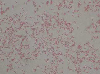 Gram negative bacilli with bipolar stain bacteria.Burkholderia pseudomallei.