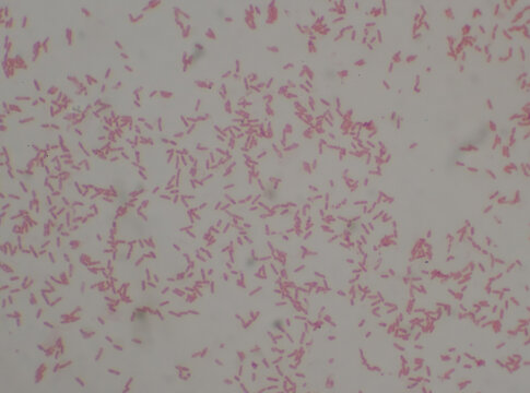 Gram Negative Bacilli With Bipolar Stain Bacteria.Burkholderia Pseudomallei.