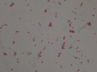 Gram negative diplococi bacteria Neisseria spp.