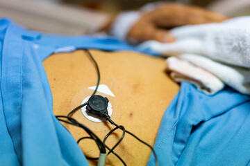 Close up sensor attach on body  old man patient for check heart rate , temperature, respiration,...