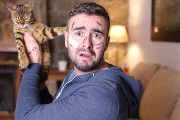Man with scratches holding bengal cat 