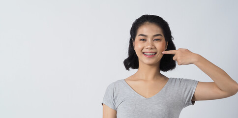 Oral Care. Dental brace teenager girl smile and looking to camera. white teeth with blue braces. Dental care. Asian woman with contact lens and orthodontic accessories. Cosmetic dentistry. white BG