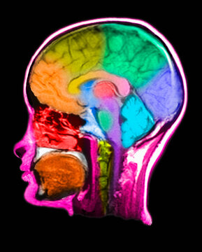 MRI Scan of human head