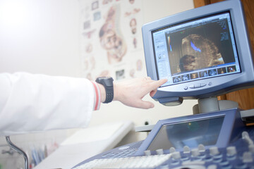 Gynecologist checking female patient's fetal life signs with ultrasound scanner.