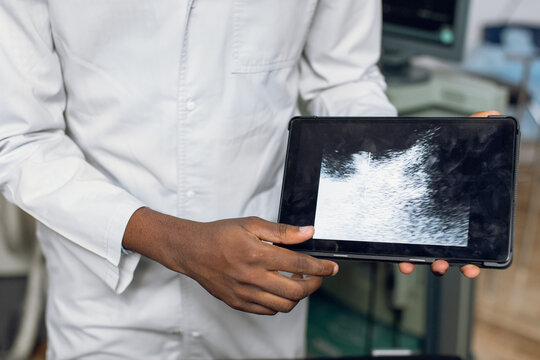 Close up cropped horizontal image of hands of dark skinned male doctor in white coat, holding digital tablet pc with ultrasound scan of the abdomen and kidney