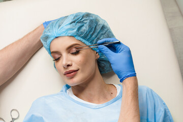 Blepharoplasty markup close-up on the face before the plastic surgery operation for modifying the...