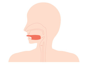 舌小帯短縮症で伸ばせない舌のイラスト　