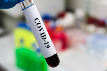 Fototapeta premium Detection of antibodies to the coronavirus.