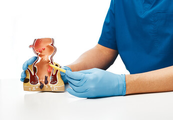 Proctologist pointing pen rectum pathologies on an anatomical model. Treatment of rectal diseases,...