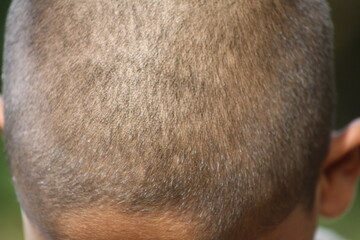 Closeup image of head. Trimmed hair