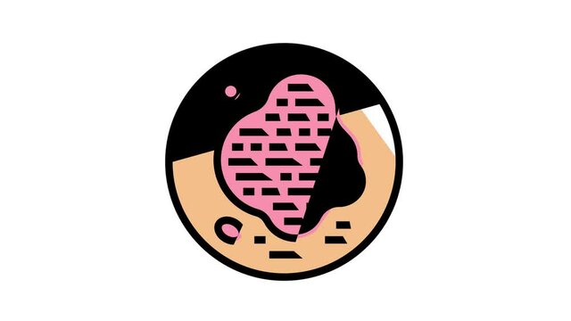 psoriasis skin disease animated color icon. psoriasis skin disease sign. isolated on white background