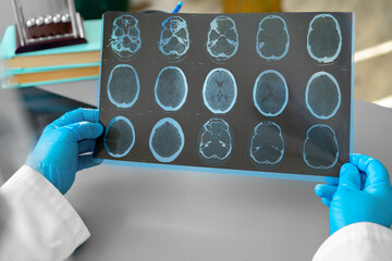 Man doctor examining head mri while sitting at the table in hospital