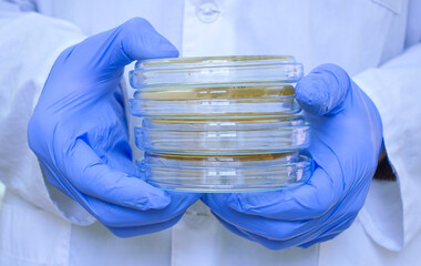 The scientist shows a stack of Petri dishes with bacteria colonies, holds a stack of four dishes in...