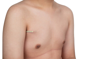 Naklejka premium Glass thermometer under the boy's arm, hand or armpit. Temperature measurement body. The boy holds under his arm a means of measuring the temperature of the human body.