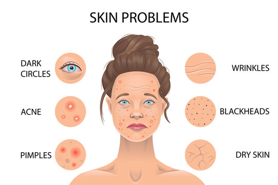 Skin Problems. Vector Illustration.
