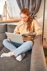 Female with artificial limb working remotely with her laptop computer