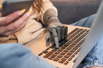 Girl with prosthesis hand typing on laptop information from smartphone