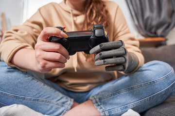 Woman with artificial limb holding gamepad and playing game