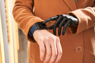 Woman with implant arm looking on smartwatch