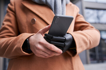 Woman with artificial limb holding her smartphone