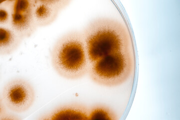 image of bacteria in laboratory placed in a receptacle
