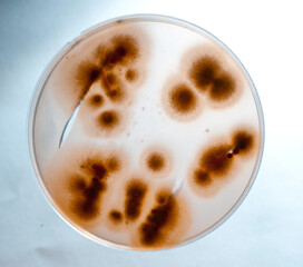 image of bacteria in laboratory placed in a receptacle