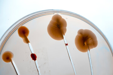 image of bacteria in laboratory placed in a receptacle