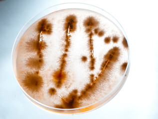 image of bacteria in laboratory placed in a receptacle