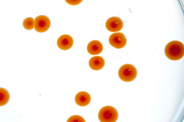 image of bacteria in laboratory placed in a receptacle