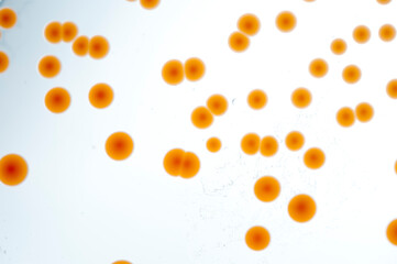image of bacteria in laboratory placed in a receptacle