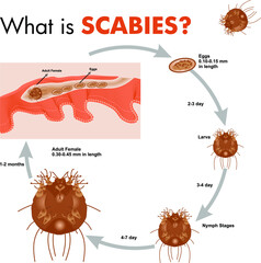 Scabies Disease poster creative design