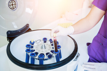 Platelet-Rich plasma preparation. Tube with blood in hands