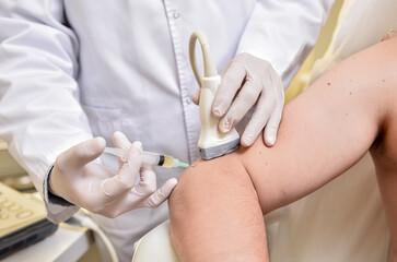 Obraz na płótnie Canvas Ultrasound-guided platelet-rich plasma injection of the elbow