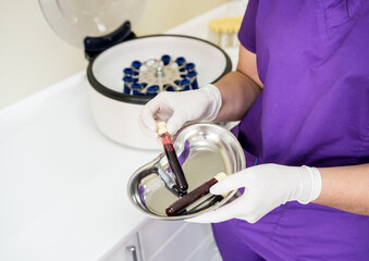 Platelet-Rich plasma preparation. Tube with blood in hands