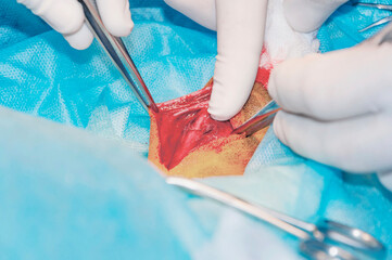 The surgeon points at fragment bone fracture. Operation of osteosynthesis