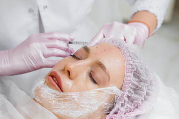 Cosmetic procedure for biorevitalization and removal of wrinkles for a young beautiful girl....