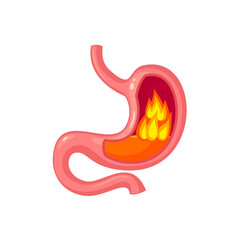 Flame in human stomach. Internal organ, anatomy. Vector cartoon flat icon illustration isolated on white background.