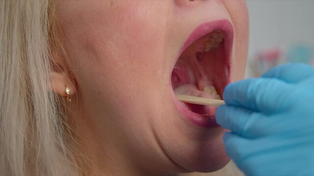 Woman opens mouth undergo oral cavity and throat examining