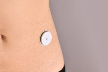 Sensor system for glucose monitoring attached to skin of person with diabetes illness used to permanently keep track of blood sugar level - obrazy, fototapety, plakaty