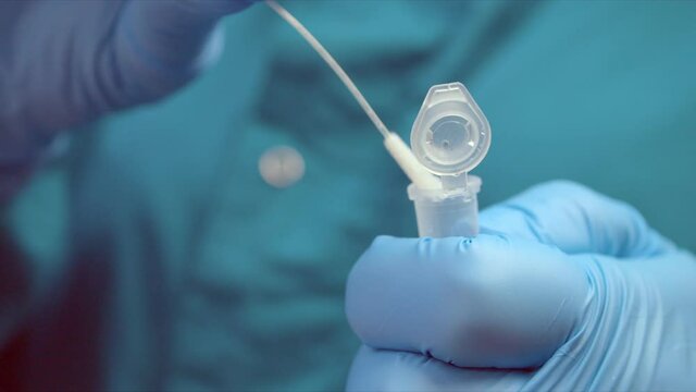 Nurse opens plastic tube puts swab with smear sample inside