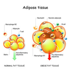 Adipocytes, obesity, and inflammation. normal, and obese adipose tissue. - obrazy, fototapety, plakaty