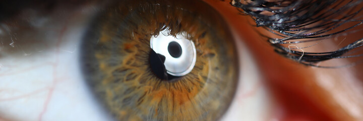 Female green-brown eye close up. Professional laser vision correction.