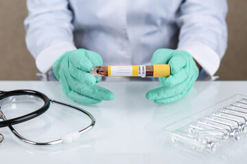 doctor's hands hold blood test tube with mock up and copy space